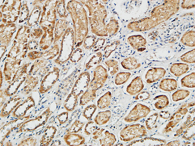 IHC - p38 Polyclonal Antibody AP71696
